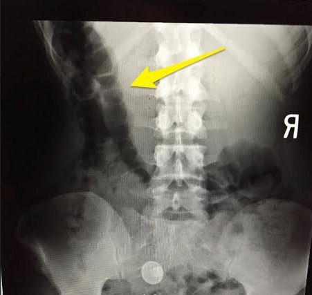 Monocromático, Fotografia monocromática, Preto e branco, Radiografia médica, Raio X, Radiografia, Imagens médicas, Radiologia, Medicina,